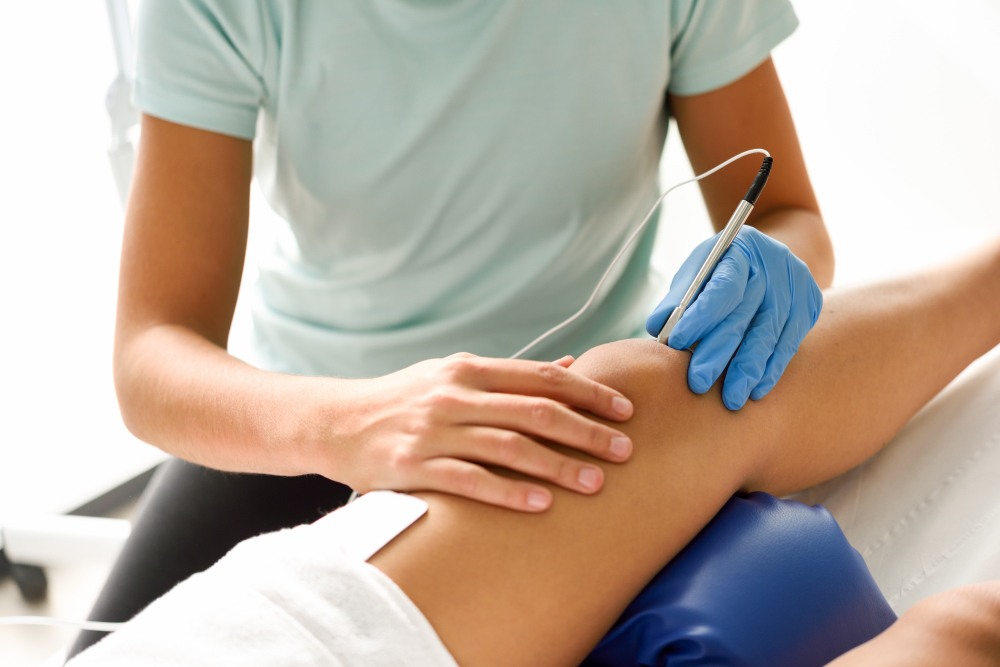 electroacupuncture dry with needle female knee